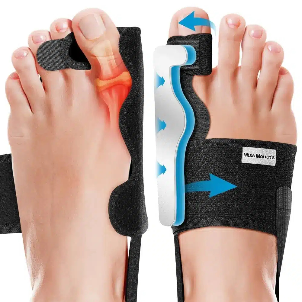 Miss_Mouth_s_Pack_01 2x KATLEAY opornica za hallux valgus s separatorji prstov - slika 1