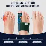 2x KATLEAY opornica za hallux valgus s separatorji prstov - slika 2