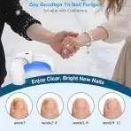 BERRLLY laserska naprava za nego nohtov - slika 2