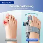 HEMEXS Nastavljiva Opornica za Hallux Valgus - slika 4